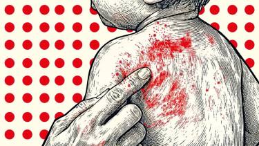 Bangladesh’s measles crisis and the question of legal responsibility